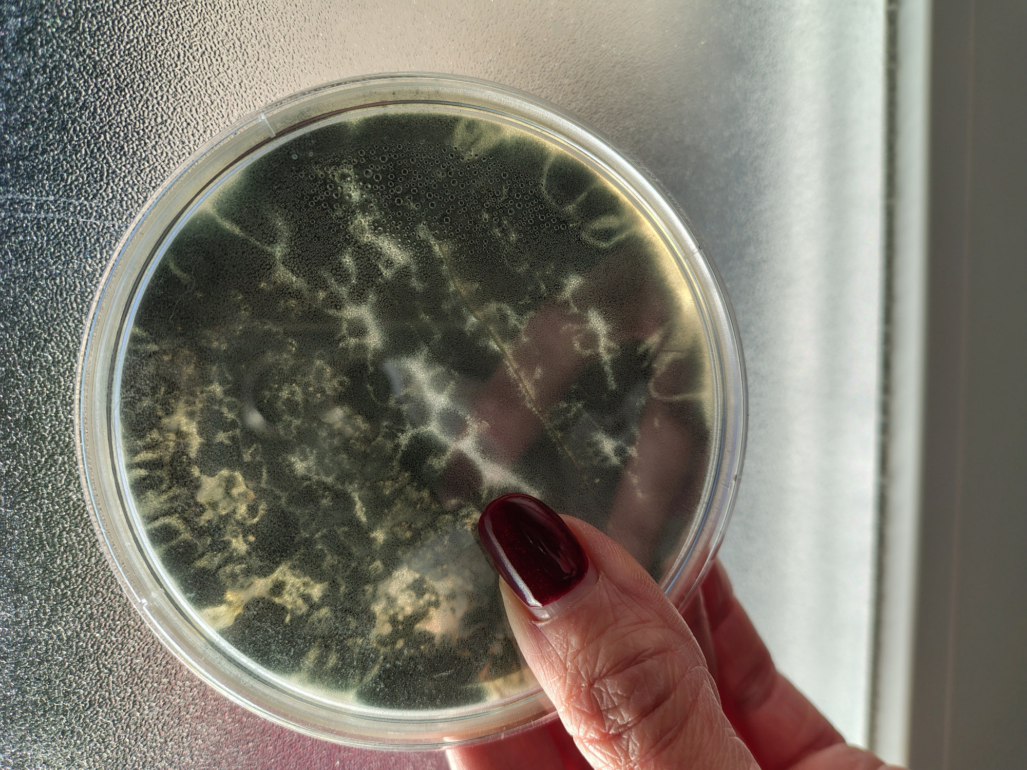 Aspergilus fumigatus