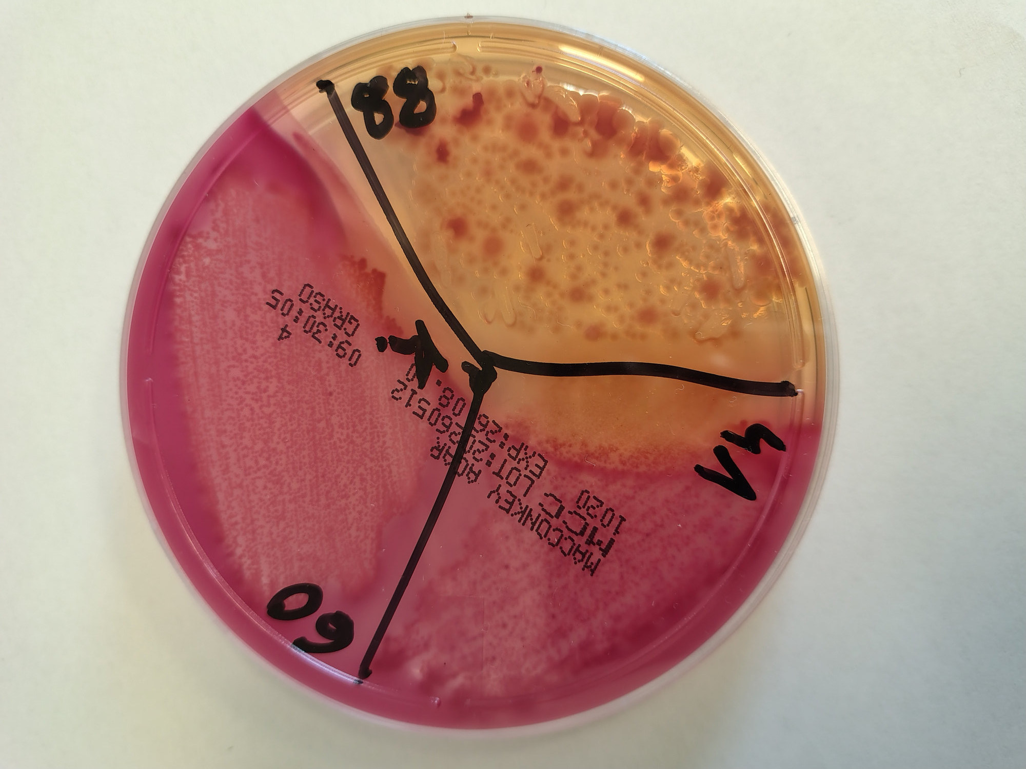 Salmonella spp1