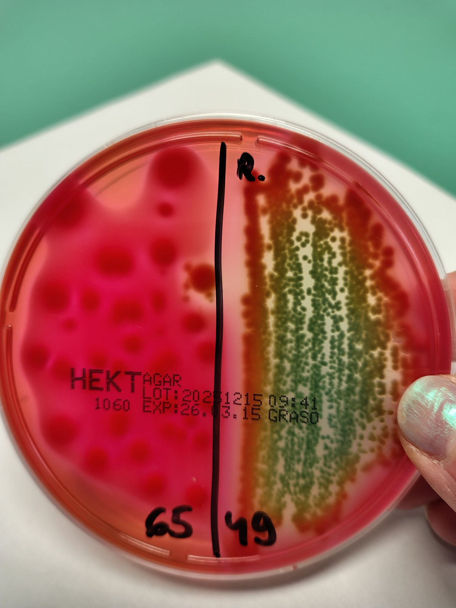 Salmonella spp2